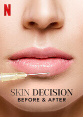 Skin Decision: Before and After